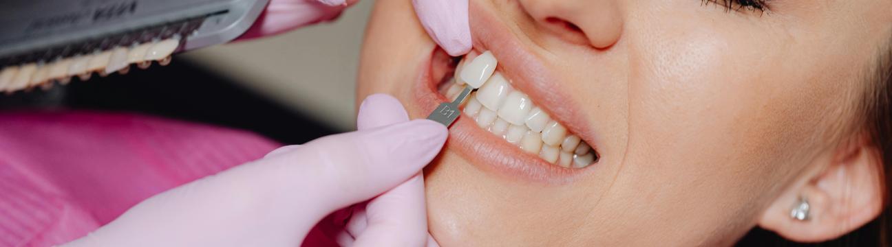 Fixed Price Dental